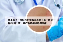 腿上張了一塊紅色的像癬可以撕下來一層皮一樣的 腿上有一塊紅色的癬塊不疼不癢