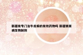 新疆有專門治牛皮癬的有效藥物嗎 新疆銀屑病生物制劑