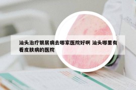 汕頭治療銀屑病去哪家醫(yī)院好啊 汕頭哪里有看皮膚病的醫(yī)院