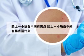 臉上一小塊白中間有黑點(diǎn) 臉上一小塊白中間有黑點(diǎn)是什么