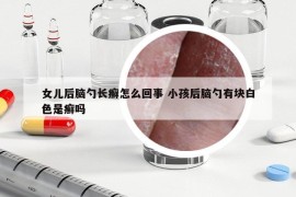 女兒后腦勺長癬怎么回事 小孩后腦勺有塊白色是癬嗎
