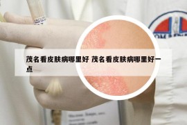 茂名看皮膚病哪里好 茂名看皮膚病哪里好一點(diǎn)