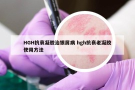HGH抗衰凝膠治銀屑病 hgh抗衰老凝膠使用方法