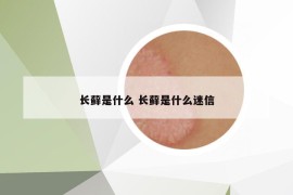 長蘚是什么 長蘚是什么迷信