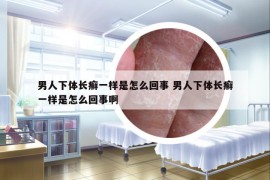 男人下體長(zhǎng)癬一樣是怎么回事 男人下體長(zhǎng)癬一樣是怎么回事啊