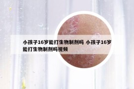 小孩子16歲能打生物制劑嗎 小孩子16歲能打生物制劑嗎視頻