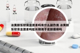 冰黃膚樂軟膏含激素嗎有什么副作用 冰黃膚樂軟膏含激素嗎能長期用于皮膚瘙癢嗎