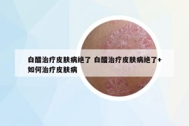 白醋治療皮膚病絕了 白醋治療皮膚病絕了+如何治療皮膚病