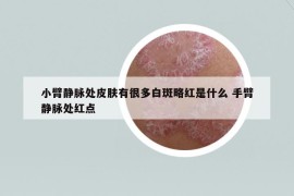小臂靜脈處皮膚有很多白斑略紅是什么 手臂靜脈處紅點