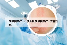 轉(zhuǎn)移因子打一針多少錢 轉(zhuǎn)移因子打一支有效嗎