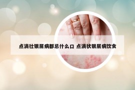 點(diǎn)滴壯銀屑病都忌什么口 點(diǎn)滴狀銀屑病飲食