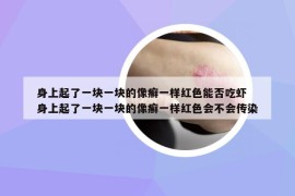 身上起了一塊一塊的像癬一樣紅色能否吃蝦 身上起了一塊一塊的像癬一樣紅色會(huì)不會(huì)傳染