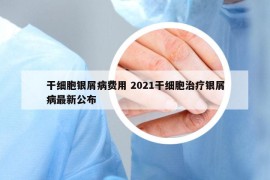 干細(xì)胞銀屑病費(fèi)用 2021干細(xì)胞治療銀屑病最新公布