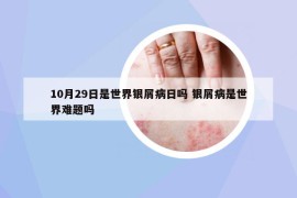 10月29日是世界銀屑病日嗎 銀屑病是世界難題嗎