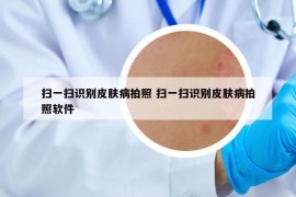 掃一掃識(shí)別皮膚病拍照 掃一掃識(shí)別皮膚病拍照軟件