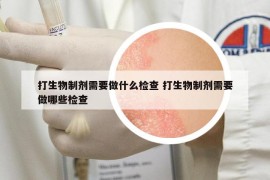 打生物制劑需要做什么檢查 打生物制劑需要做哪些檢查