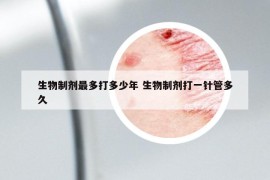 生物制劑最多打多少年 生物制劑打一針管多久