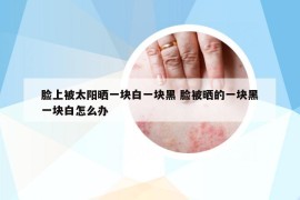 臉上被太陽曬一塊白一塊黑 臉被曬的一塊黑一塊白怎么辦