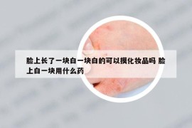 臉上長了一塊白一塊白的可以摸化妝品嗎 臉上白一塊用什么藥