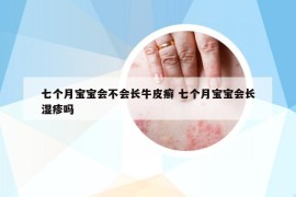 七個月寶寶會不會長牛皮癬 七個月寶寶會長濕疹嗎