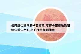 貴陽濟(jì)仁堂療癬卡西甫散 療癬卡西甫散貴陽濟(jì)仁堂生產(chǎn)的,它的作用和副作用