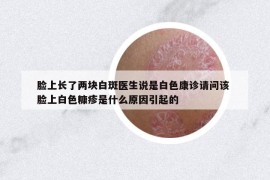 臉上長了兩塊白斑醫(yī)生說是白色康診請問該 臉上白色糠疹是什么原因引起的
