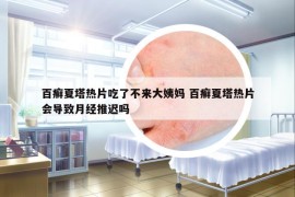 百癬夏塔熱片吃了不來大姨媽 百癬夏塔熱片會導(dǎo)致月經(jīng)推遲嗎