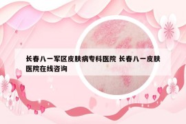 長春八一軍區(qū)皮膚病?？漆t(yī)院 長春八一皮膚醫(yī)院在線咨詢
