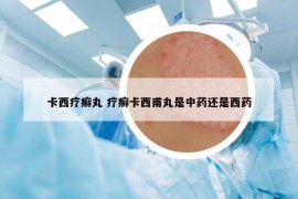 卡西療癬丸 療癬卡西甫丸是中藥還是西藥