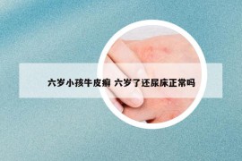 六歲小孩牛皮癬 六歲了還尿床正常嗎