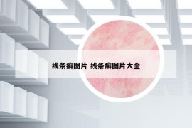 線條癬圖片 線條癬圖片大全