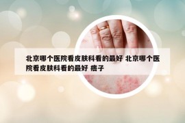 北京哪個醫(yī)院看皮膚科看的最好 北京哪個醫(yī)院看皮膚科看的最好 痦子