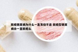 膿皰銀屑病為什么一直發(fā)燒不退 膿皰型銀屑病會(huì)一直膿皰么
