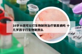10歲小孩可以打生物制劑治療銀屑病嗎 十幾歲孩子打生物制劑么