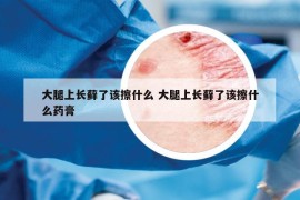 大腿上長蘚了該擦什么 大腿上長蘚了該擦什么藥膏