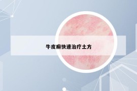牛皮癬快速治療土方