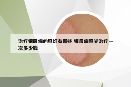 治療銀屑病的照燈有那些 銀屑病照光治療一次多少錢