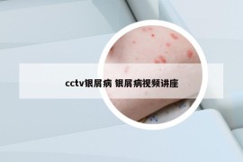 cctv銀屑病 銀屑病視頻講座