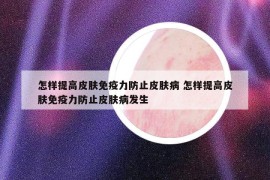 怎樣提高皮膚免疫力防止皮膚病 怎樣提高皮膚免疫力防止皮膚病發(fā)生
