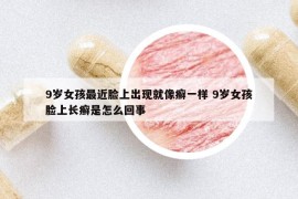 9歲女孩最近臉上出現(xiàn)就像癬一樣 9歲女孩臉上長癬是怎么回事