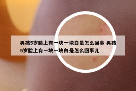男孩5歲臉上有一塊一塊白是怎么回事 男孩5歲臉上有一塊一塊白是怎么回事兒