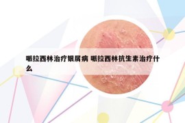 哌拉西林治療銀屑病 哌拉西林抗生素治療什么