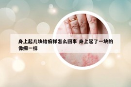 身上起幾塊給癬樣怎么回事 身上起了一塊的像癬一樣