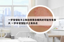 一歲寶寶肚子上有白斑事白癜風(fēng)的可能性有多大 一歲半寶寶肚子上有白點(diǎn)