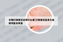長期打修美樂會得什么病 打修美樂后多久免疫功能會恢復(fù)