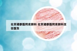 北京建都醫(yī)院皮膚科 北京建都醫(yī)院皮膚科主任醫(yī)生
