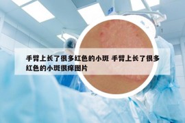手臂上長(zhǎng)了很多紅色的小斑 手臂上長(zhǎng)了很多紅色的小斑很癢圖片