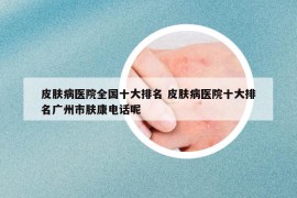 皮膚病醫(yī)院全國十大排名 皮膚病醫(yī)院十大排名廣州市膚康電話呢