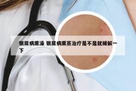 銀屑病熏澡 銀屑病熏蒸治療是不是就緩解一下