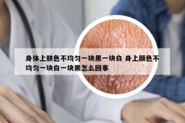 身體上膚色不均勻一塊黑一塊白 身上顏色不均勻一塊白一塊黑怎么回事